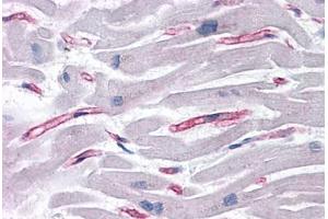 Human Heart: Formalin-Fixed, Paraffin-Embedded (FFPE) (SLAIN1 抗体  (C-Term))