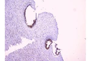 IHC analysis of PBP using anti-PBP antibody (ABIN5693043). (PEBP1 抗体)