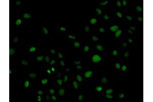 Immunofluorescence analysis of HeLa cell using PLCG2 antibody. (Phospholipase C gamma 2 抗体  (AA 1-300))