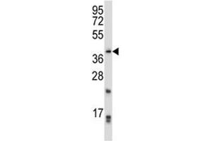 PITX2 antibody western blot analysis in CEM lysate. (PITX2 抗体  (AA 42-71))