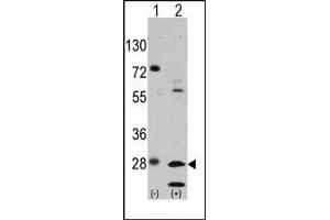 Image no. 1 for anti-Growth Factor Receptor-Bound Protein 2 (GRB2) (Tyr209) antibody (ABIN358793) (GRB2 抗体  (Tyr209))