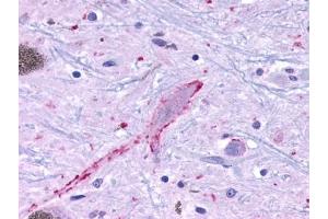 Immunohistochemical staining of Brain (Neurons and glia) using anti- MRGPRF antibody ABIN122237