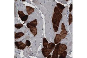 Immunohistochemical staining (Formalin-fixed paraffin-embedded sections) of human skeletal muscle with MYH6 monoclonal antibody, clone CL2162  shows strong cytoplasmic immunoreactivity in a subset of striated muscle fibers. (MYH6 抗体)