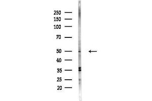 anti-Protein Phosphatase 4, Regulatory Subunit 1-Like (PPP4R1L) (C-Term) antibody