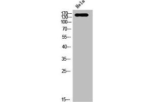 Western Blotting (WB) image for anti-Neurotrophic tyrosine Kinase, Receptor, Type 3 (NTRK3) (pTyr516) antibody (ABIN7182916)