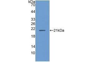Detection of Recombinant ANP32A, Human using Polyclonal Antibody to Acidic Nuclear Phosphoprotein 32 Family, Member A (ANP32A) (PHAP1 抗体  (AA 2-175))