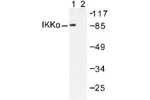 Image no. 1 for anti-conserved Helix-Loop-Helix Ubiquitous Kinase (CHUK) antibody (ABIN265477) (IKK alpha 抗体)