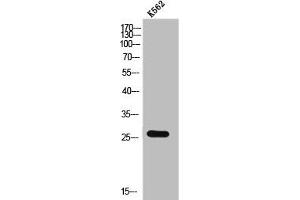 Western Blot analysis of K562 cells using CMTM2 Polyclonal Antibody (CMTM2 抗体  (C-Term))