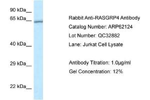 Western Blotting (WB) image for anti-RAS Guanyl Releasing Protein 4 (RASGRP4) (N-Term) antibody (ABIN2789029) (RASGRP4 抗体  (N-Term))