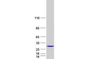 Western Blotting (WB) image for Phosphatidylcholine Transfer Protein (PCTP) (Transcript Variant 1) protein (Myc-DYKDDDDK Tag) (ABIN2728453)