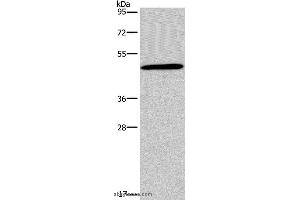 Western blot analysis of 293T cell, using GCGR Polyclonal Antibody at dilution of 1:200 (Glucagon Receptor 抗体)