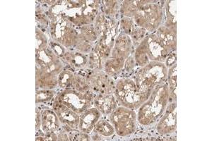 Immunohistochemical staining of human kidney with LEMD3 polyclonal antibody  shows nuclear positivity often accentuated to the membrane in renal tubules. (LEMD3 抗体)