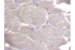 Immunohistochemistry (IHC) analyzes of IKKα/β antibody in paraffin-embedded human skeletal muscle tissue. (IKK alpha 抗体)