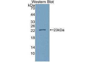 Western Blotting (WB) image for anti-Interleukin 37 (IL37) (AA 46-218) antibody (ABIN1980442) (IL-37 抗体  (AA 46-218))