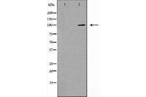 Western blot analysis of extracts from Jurkat cells using CDH17 antibody. (LI Cadherin 抗体  (Internal Region))