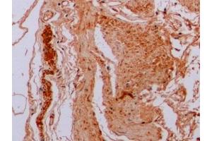 Immunohistochemistry (IHC) image for anti-Tubulin, beta (TUBB) (AA 170-419) antibody (ABIN7428962)