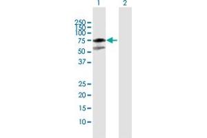 Western Blot analysis of MDM4 expression in transfected 293T cell line by MDM4 MaxPab polyclonal antibody. (MDM4-binding Protein 抗体  (AA 1-490))