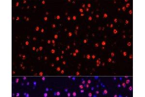 Immunofluorescence analysis of Mouse brain using Phospho-Stat3(Y705) Polyclonal Antibody at dilution of 1:100 (40x lens). (STAT3 抗体  (pTyr705))