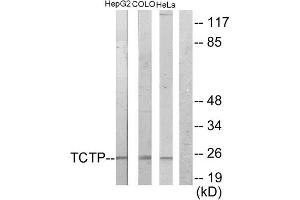 Western Blotting (WB) image for anti-Tumor Protein, Translationally-Controlled 1 (TPT1) (Internal Region) antibody (ABIN1849166) (TPT1 抗体  (Internal Region))