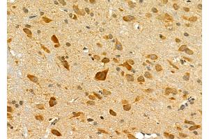 ABIN6257607 and ABIN6275769 at 1/100 staining Rat brain tissue by IHC-P. (IL11RA 抗体  (C-Term))