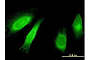 Immunofluorescence of monoclonal antibody to STAU1 on HeLa cell.
