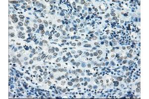 Image no. 16 for anti-P450 (Cytochrome) Oxidoreductase (POR) antibody (ABIN1497746) (POR 抗体)