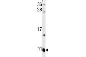 Western blot analysis of S100A6 antibody and mouse lung tissue lysate. (S100A6 抗体  (AA 37-67))