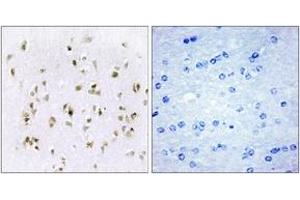 Immunohistochemistry analysis of paraffin-embedded human brain tissue, using HMG17 Antibody. (HMGN2 抗体  (AA 1-50))