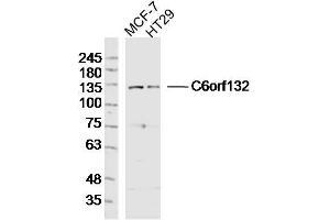 Lane 1: MCF-7 lysates Lane 2: HT29 lysates probed with C6orf132 Polyclonal Antibody, Unconjugated  at 1:300 dilution and 4˚C overnight incubation. (C6ORF132 抗体  (AA 1001-1188))