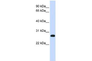 WB Suggested Anti-SNAP23 Antibody Titration:  0. (SNAP23 抗体  (N-Term))