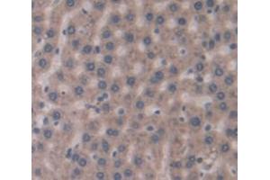 IHC-P analysis of Rat Tissue, with DAB staining. (GCKR 抗体  (AA 320-499))