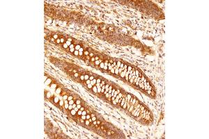 Immunohistochemical analysis of (ABIN653144 and ABIN2842716) on paraffin-embedded human appendix tissue was performed on the Leica®BOND RXm.