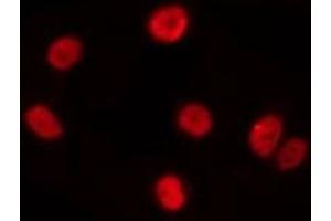 ABIN6275537 staining A549 by IF/ICC. (PRKX 抗体  (Internal Region))