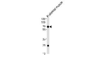 Western blot analysis of lysate from human skeletal muscle tissue lysate, using C4orf18 Antibody (Center) (ABIN657887 and ABIN2846841). (FAM198B 抗体  (AA 275-304))