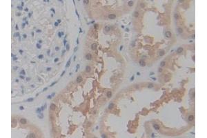 DAB staining on IHC-P; Samples: Human Kidney Tissue (P2RX7 抗体  (AA 47-334))