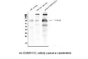 Anti-CD68 antibody, Western blotting Lane 1: Rat Spleen Tissue Lysate Lane 2: Mouse Spleen  Tissue Lysate Lane 3: Mouse RAW246. (CD68 抗体  (Middle Region))