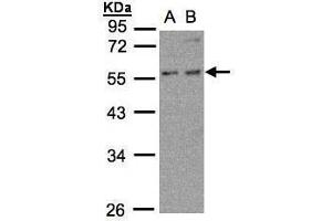 WB Image Sample (30μg whole cell lysate) A:MOLT4 , B:Raji , 10% SDS PAGE antibody diluted at 1:500 (PFKFB4 抗体)