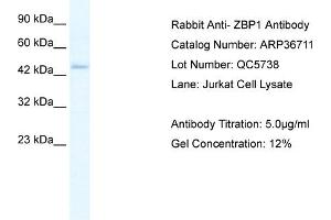 WB Suggested Anti-ZBP1 Antibody Titration: 5. (ZBP1 抗体  (Middle Region))