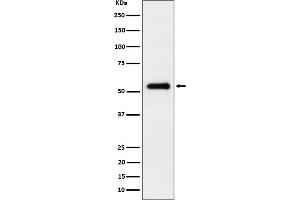 Western blot analysis of PRD expression in HepG2 cell lysate. (Recombinant Primary Retinal Dysplasia (PRD) 抗体)