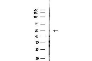 Western blot analysis of lysates from PC12 cells(LPS 4h treatment), using HYAL1 Antibody at 1/1000 dilution.