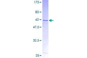 Annexin A10 (ANXA10) (AA 1-324) protein (GST tag)