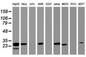 Image no. 3 for anti-Hydroxysteroid (17-Beta) Dehydrogenase 8 (HSD17B8) (AA 57-261) antibody (ABIN1491596) (HSD17B8 抗体  (AA 57-261))