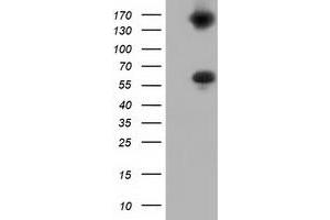 Western Blotting (WB) image for anti-Butyrophilin, Subfamily 1, Member A1 (BTN1A1) antibody (ABIN1496991) (BTN1A1 抗体)
