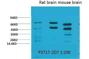 Western Blot (WB) analysis of 1) HeLa, 2)Rat Brain Tissue, 3) Mouse Brain Tissue with Phosphoserine Mouse Monoclonal Antibody diluted at 1:2000. (Phosphoserine 抗体  (phosphorylated))