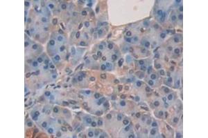 IHC-P analysis of Human Tissue, with DAB staining. (Dystrobrevin beta 抗体  (AA 1-249))