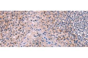 Immunohistochemistry of paraffin-embedded Human tonsil tissue using ITIH4 Polyclonal Antibody at dilution of 1:50(x200) (ITIH4 抗体)