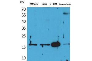 Western Blot (WB) analysis of 22RV-1, H460, U87, Mouse Brain cells using Apelin Polyclonal Antibody.