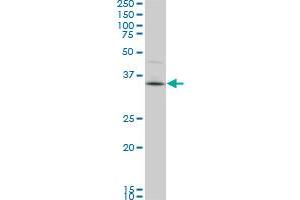 Western Blotting (WB) image for anti-PDZ Binding Kinase (PBK) (AA 1-110) antibody (ABIN599273) (PBK 抗体  (AA 1-110))