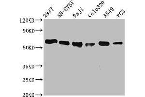 Western Blot Positive WB detected in: 293T whole cell lysate, SH-SY5Y whole cell lysate, Raji whole cell lysate, Colo320 whole cell lysate, A549 whole cell lysate, PC3 whole cell lysate All lanes: FTO antibody at 0. (Recombinant FTO 抗体)