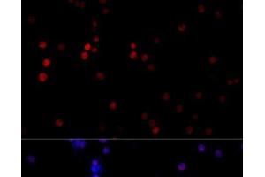 Immunofluorescence analysis of PC-12 cells using TBP Polyclonal Antibody at dilution of 1:100 (40x lens). (TBP 抗体)